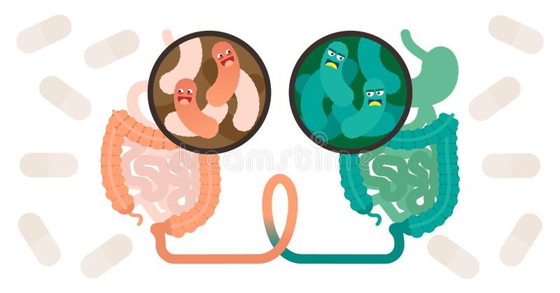 Healthy stool from fecal transplant in an IBS patient’s digestive track reduces&nbsp;symptoms